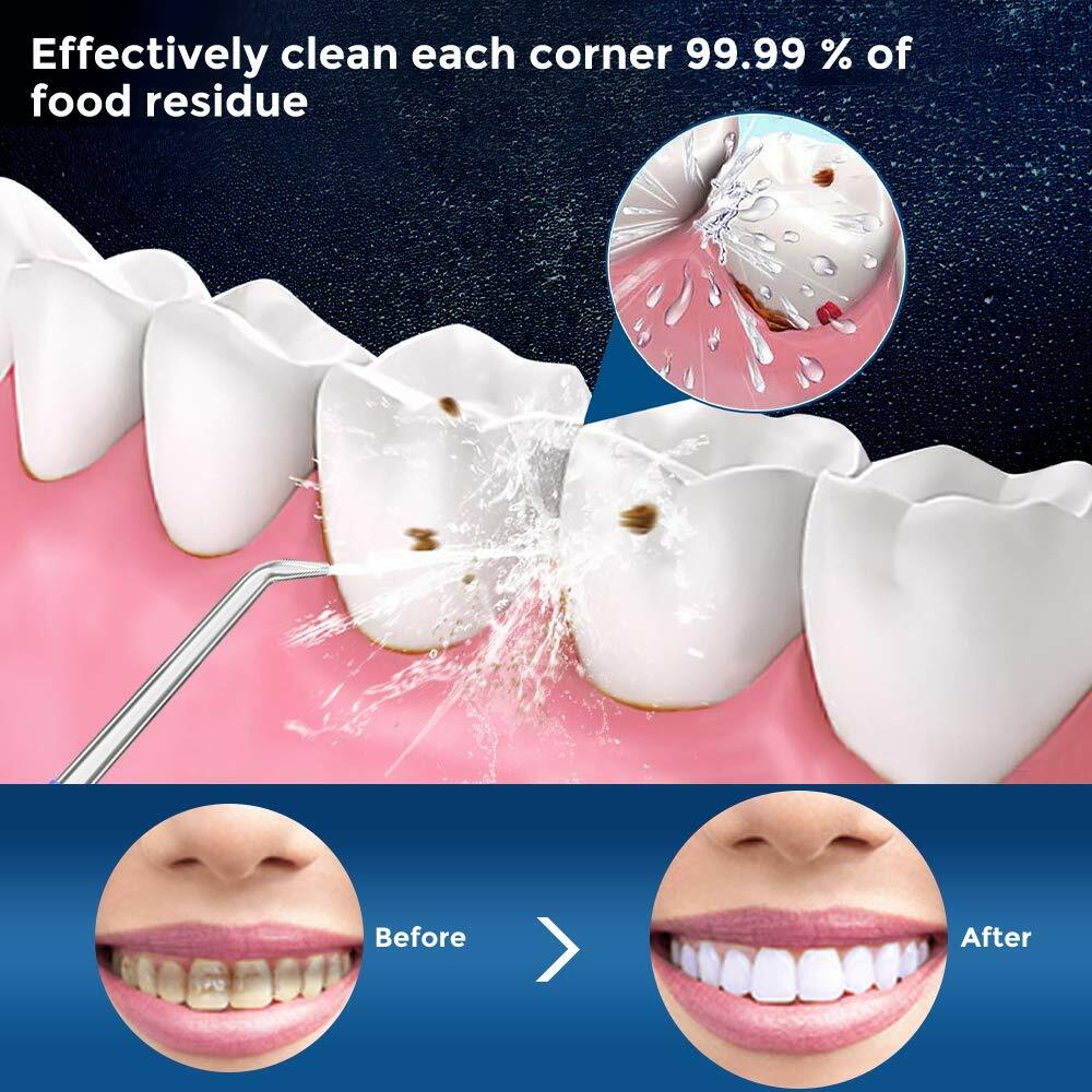 Cordless Water Flosser Oral Irrigator with 5 Jet Tips, Rechargeable Portable Dental Cleaner