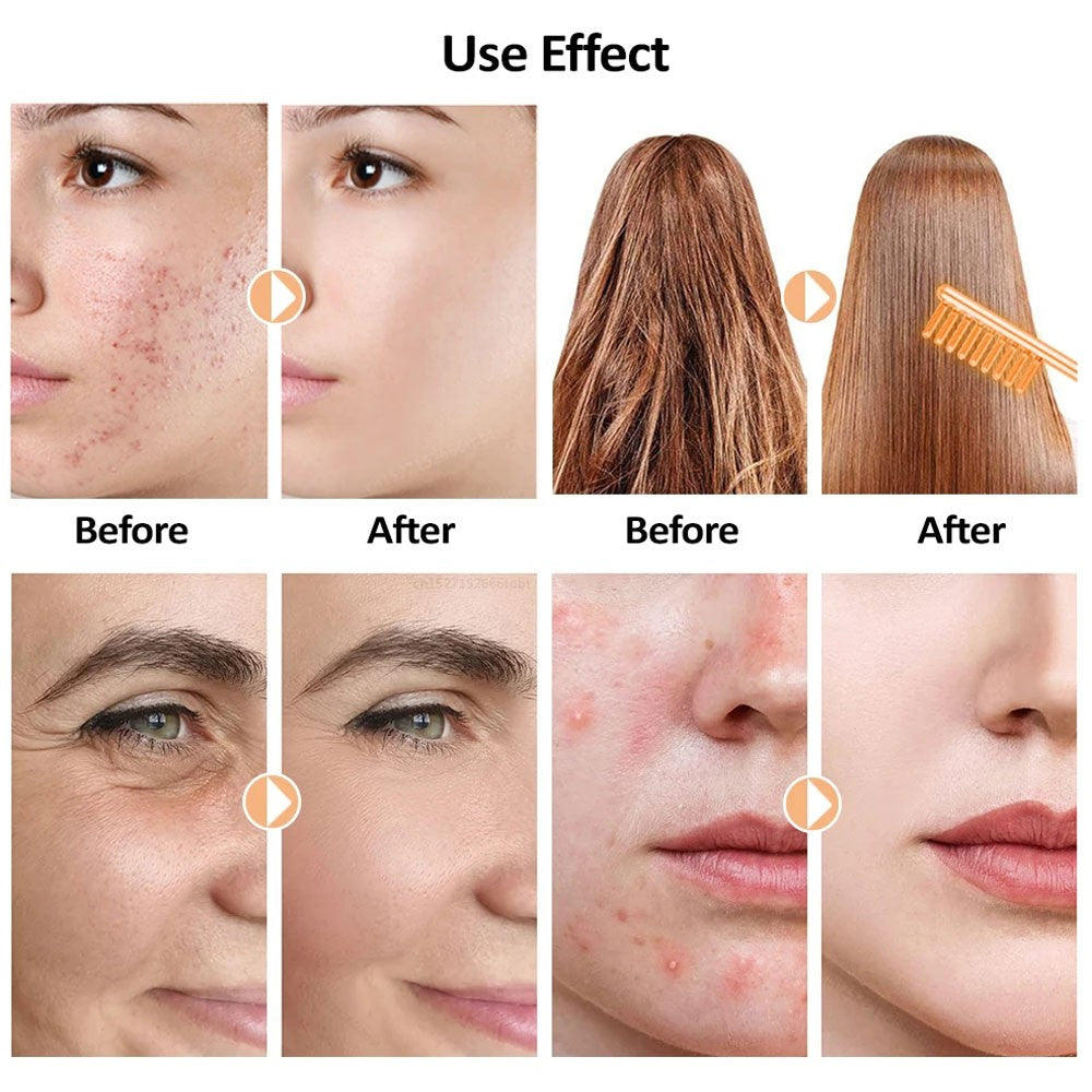 High Frequency Facial Device for Skin Care & Anti-Aging