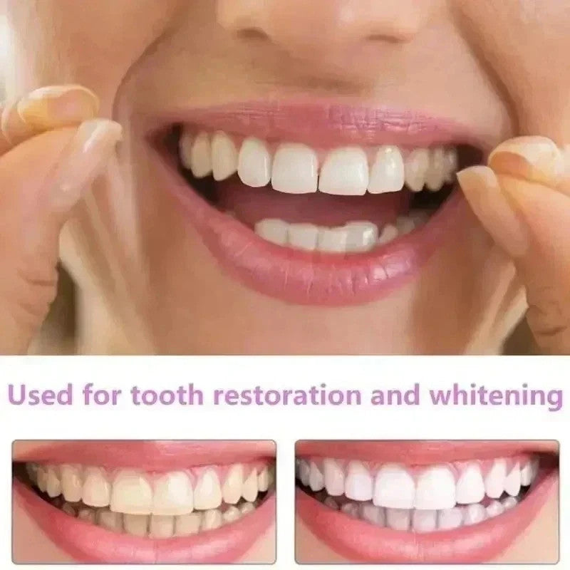 Snap-On Veneers Teeth Kit for Women and Men - Instant Bright Smile