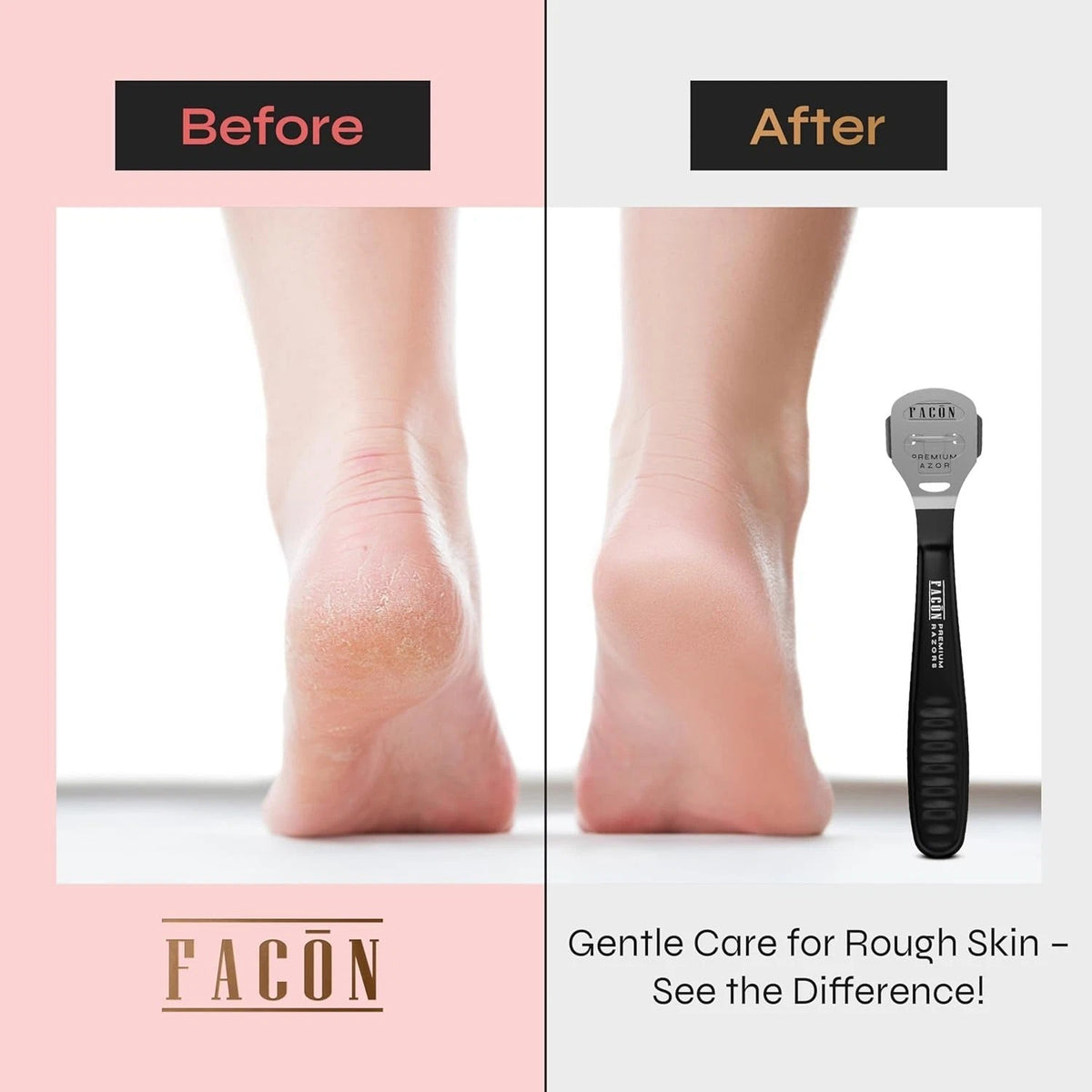 Professional Callus Remover Shaver with 50 Blades - Pedicure Foot Tool