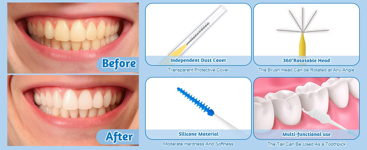 Interdental Brush Set with 255 Pieces for Braces and Teeth Cleaning