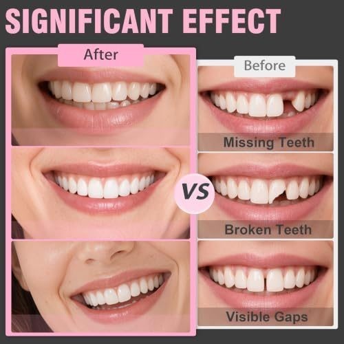 Temporary Veneers Teeth for Women & Men Natural Shade - Cosmetic Smile Enhancer