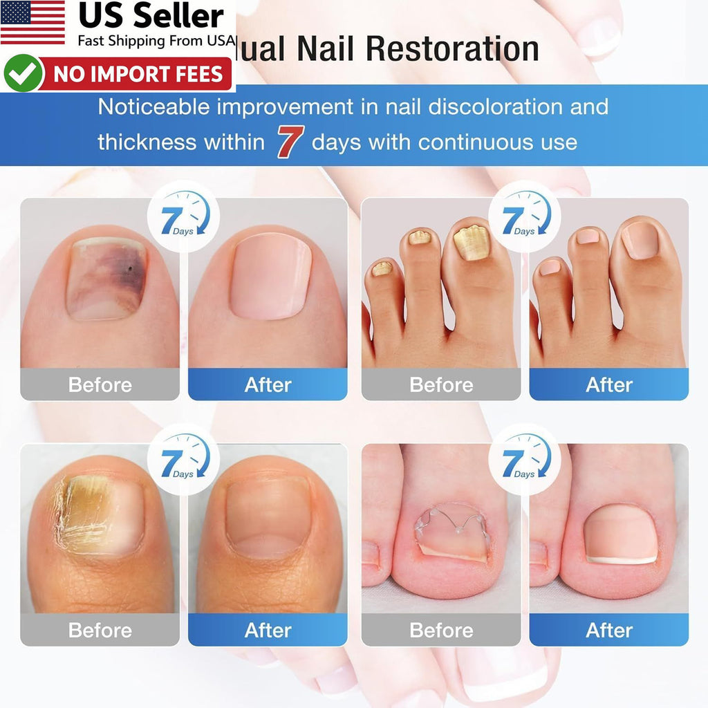 Fungal Nail Treatment Patches 60 Pack - Toenail Repair & Discoloration Relief