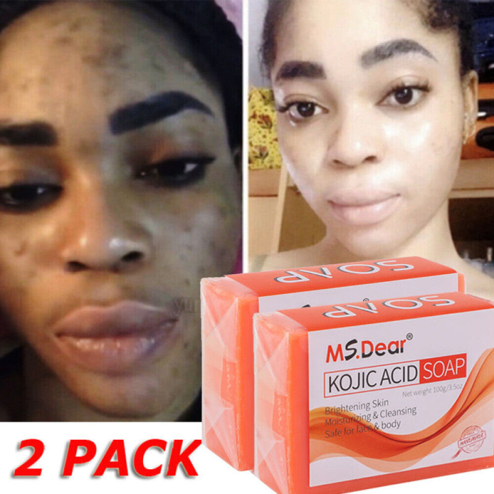 Kojic Acid Brightening Bar Soap for Dark Spot & Acne Removal - 100g