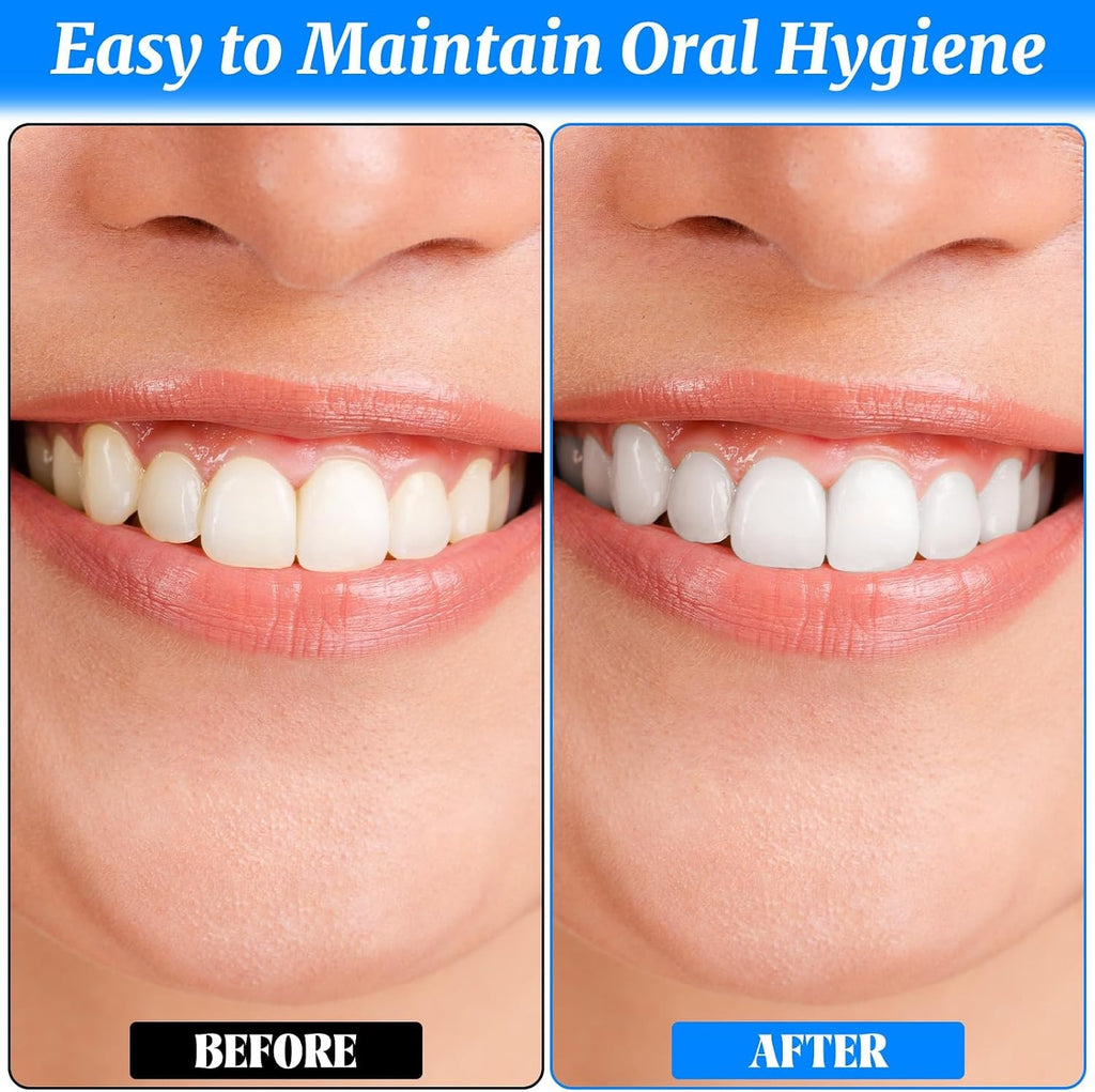 4 Pack Dental Tooth Stain Removers & Plaque Erasers for Oral Care