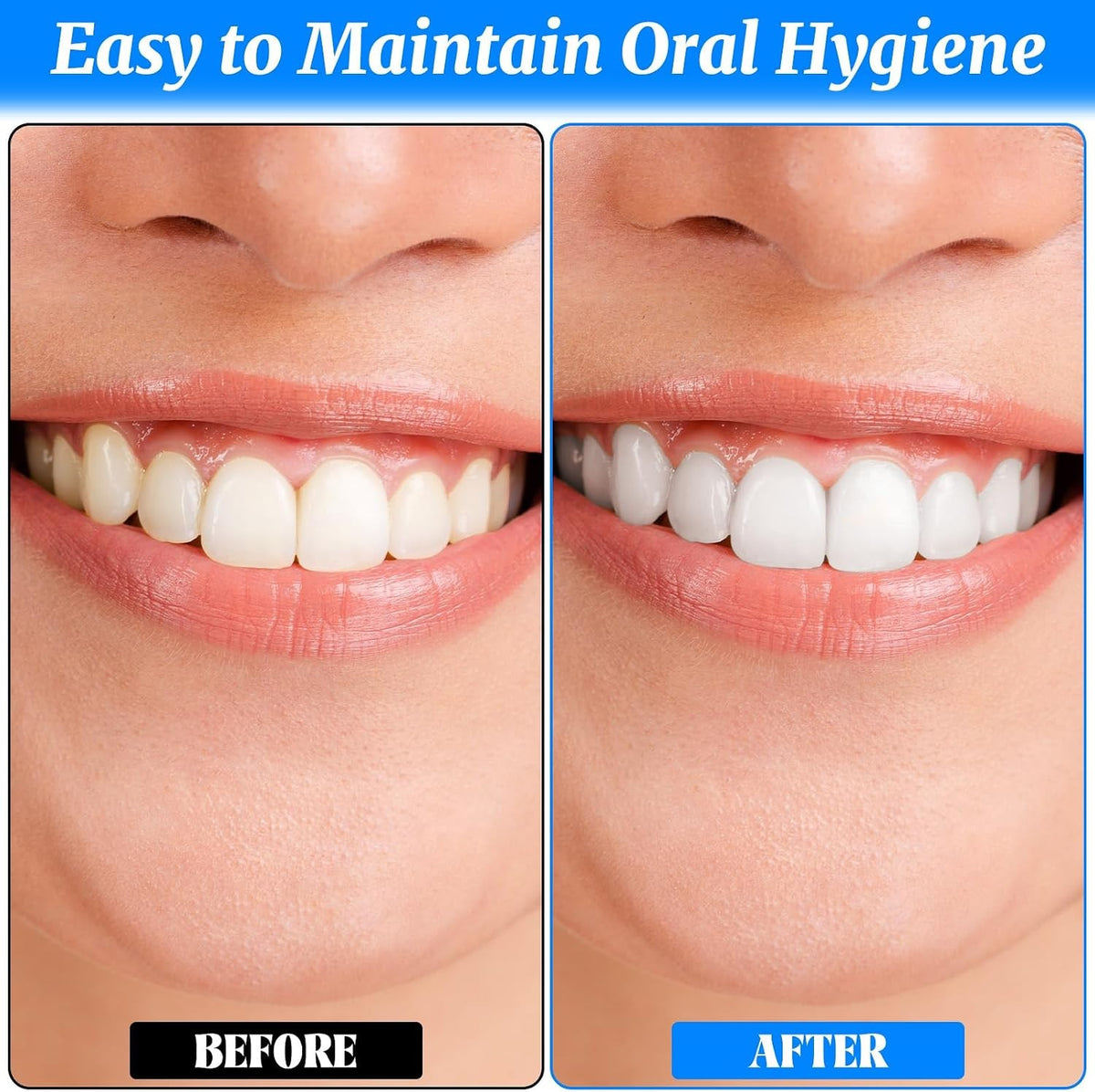 4 Pack Dental Tooth Stain Removers & Plaque Erasers for Oral Care