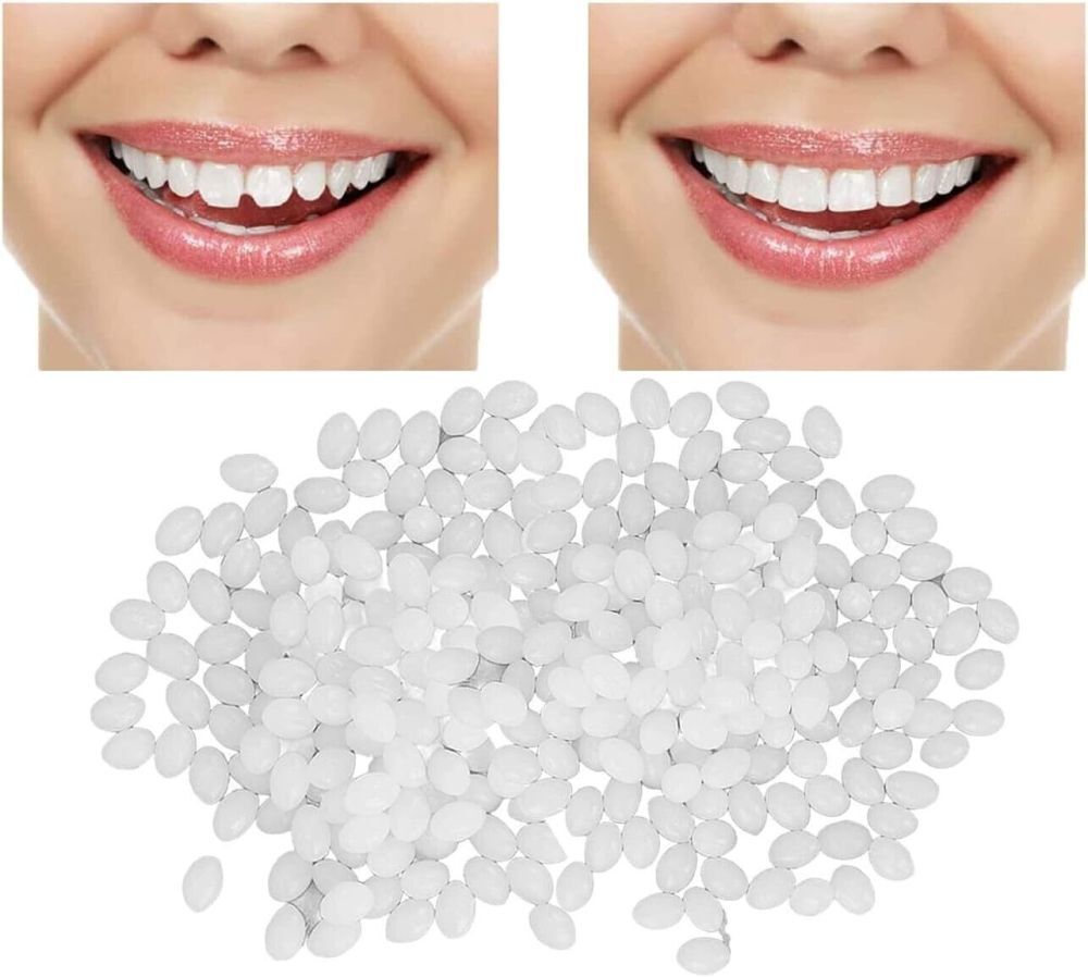 Teeth Repair Beads for Loose Tooth Fixing - Temporary Dental Moldable Resin