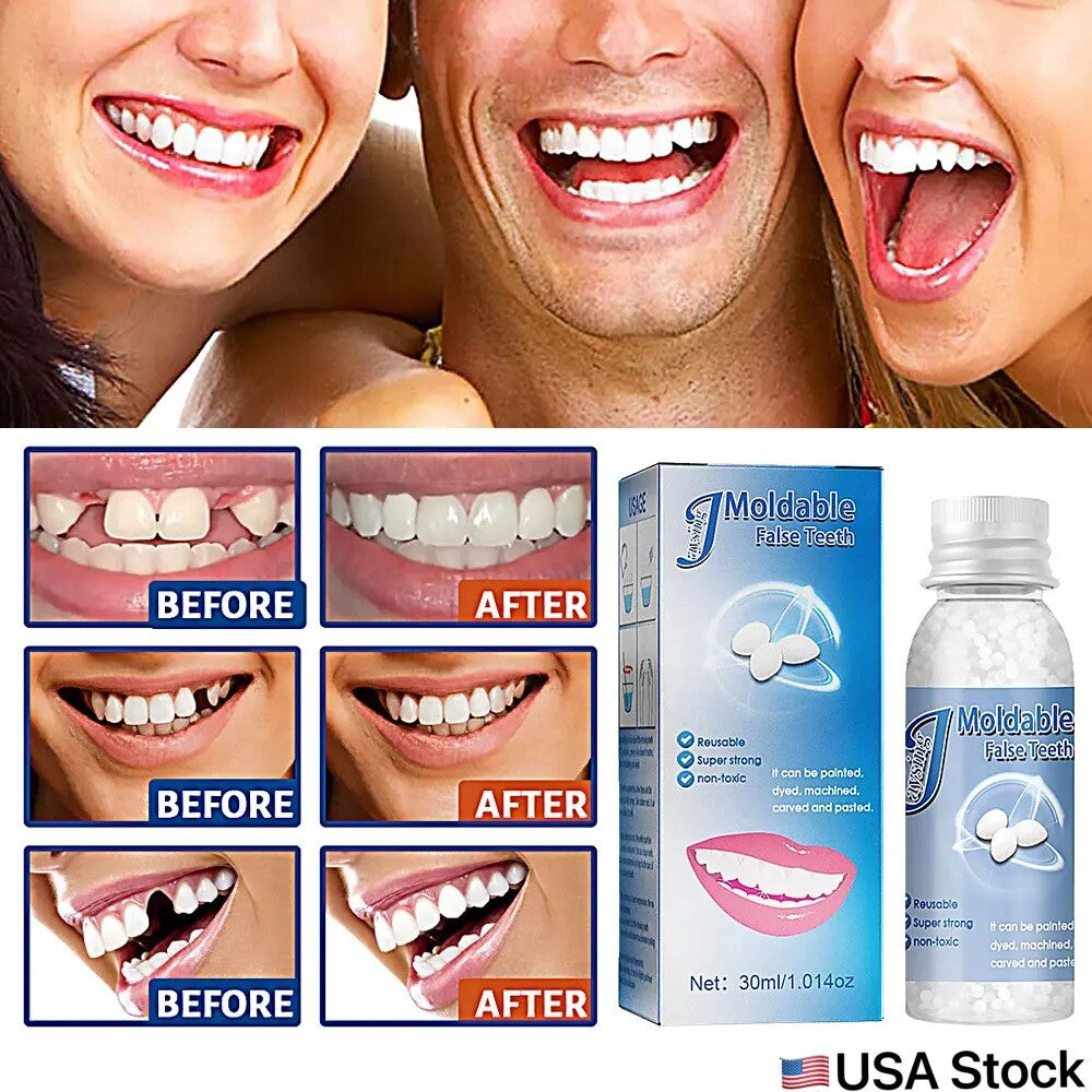 Dental Restoration Kit Moldable Bead for Filling and Repair - All Variants