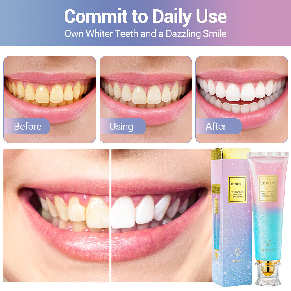Niacinamide Whitening Toothpaste Natural Enamel Care 100g - Fresh Mint