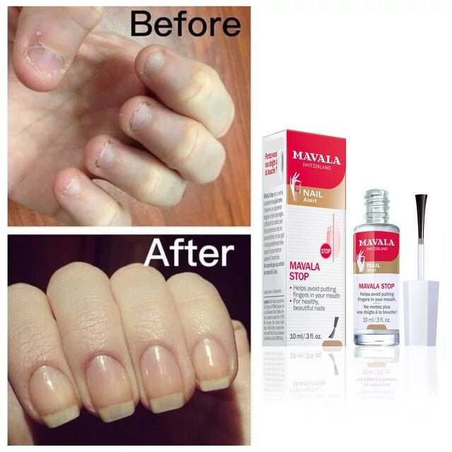 Deterrent Nail Polish Treatment for Nail-Biting - Clear, 0.3oz