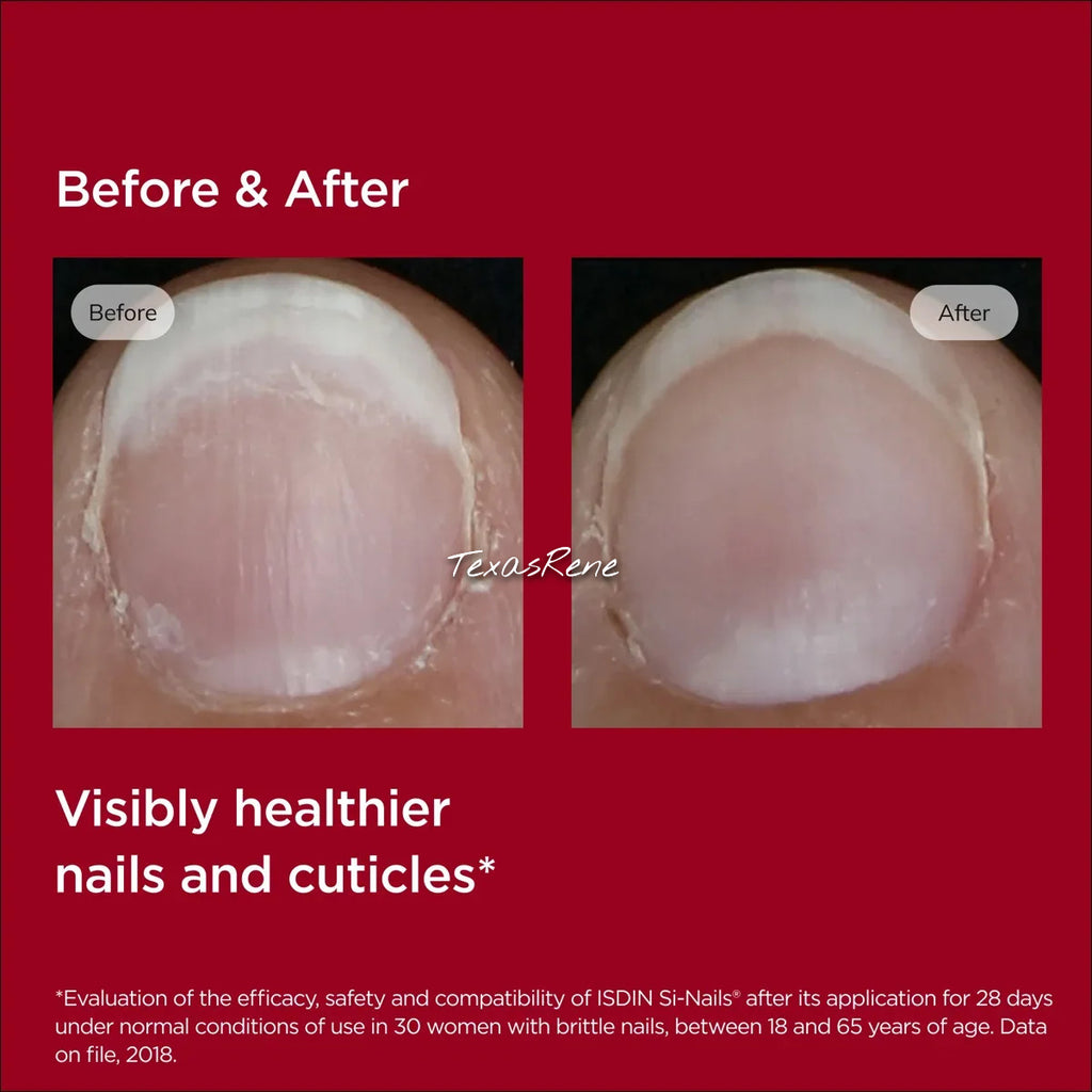 Nail Strengthener Serum - Clear Liquid Treatment for Brittle Nails 2.5ml