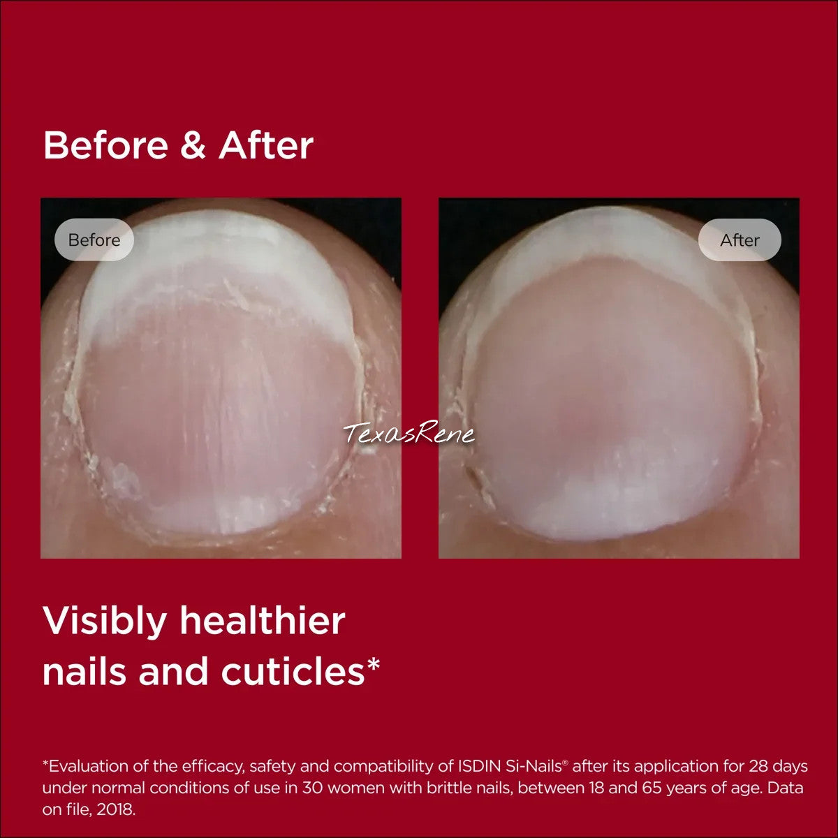 Nail Strengthener Serum - Clear Liquid Treatment for Brittle Nails 2.5ml
