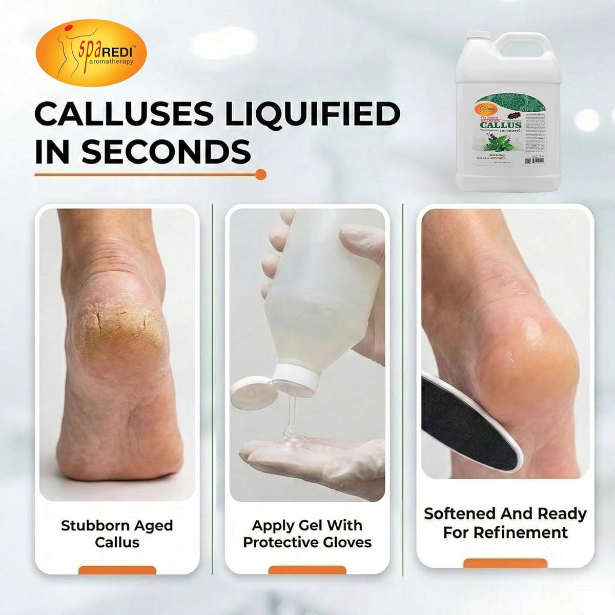 Professional Callus Remover for Feet - Mint & Eucalyptus, 1 Gallon