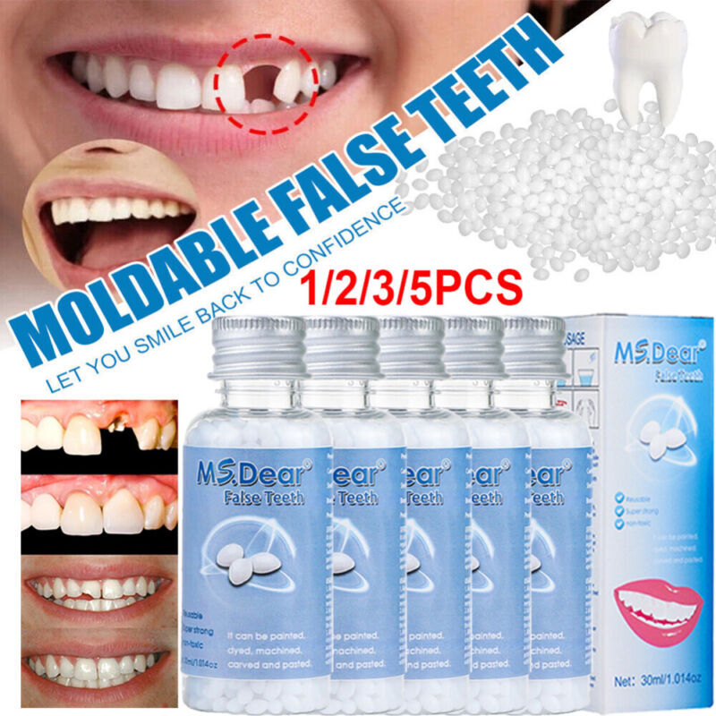 Reusable Moldable Tooth Repair Kit - Temporary Beads for Broken Gaps