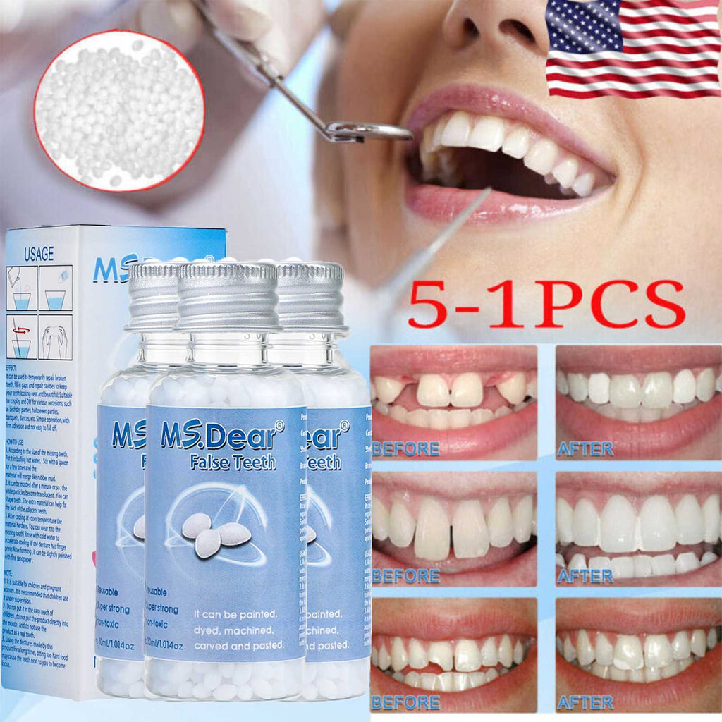 Temporary Moldable Dental Repair Pellets for Broken Teeth & Gaps - 5X Pack
