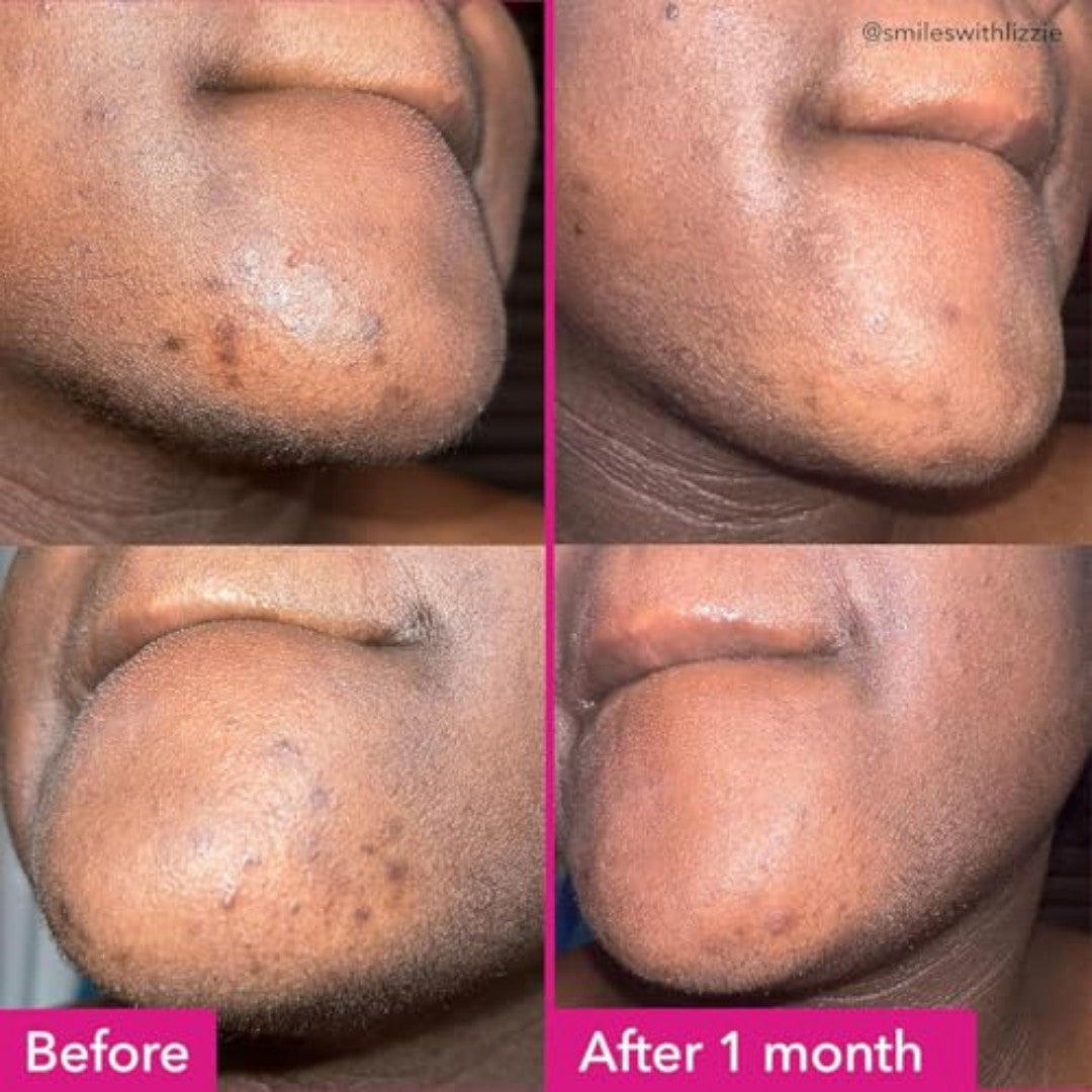 Brightening & Dark Spots Face and Body Bar - Soap-Free, pH-Balanced