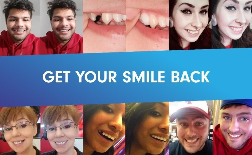 Temporary Tooth Replacement Kit - DIY Natural Smile Repair
