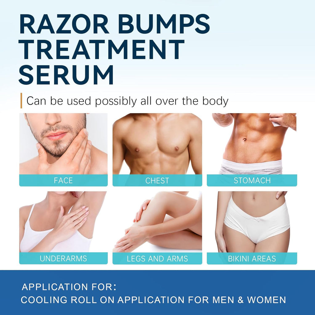 Ingrown Hair Treatment Serum for Razor Bumps & Skin Smoothing - 3.38 Fl Oz
