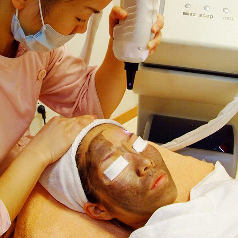 Carbon Gel for Laser Skin Rejuvenation - 3 Pack for Nd YAG Facial Treatments