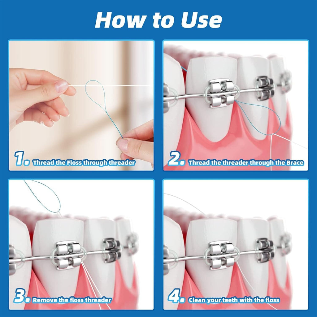 Dental Floss Threaders for Braces Bridges Implants - 200 Count