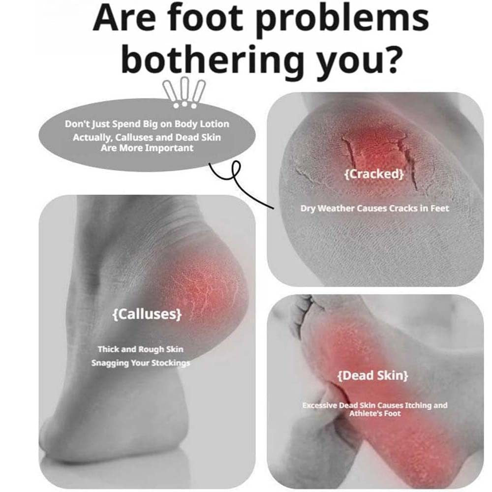 Double-Sided Foot Scraper Callus Remover for Dead Skin Removal - Spa & Home Use