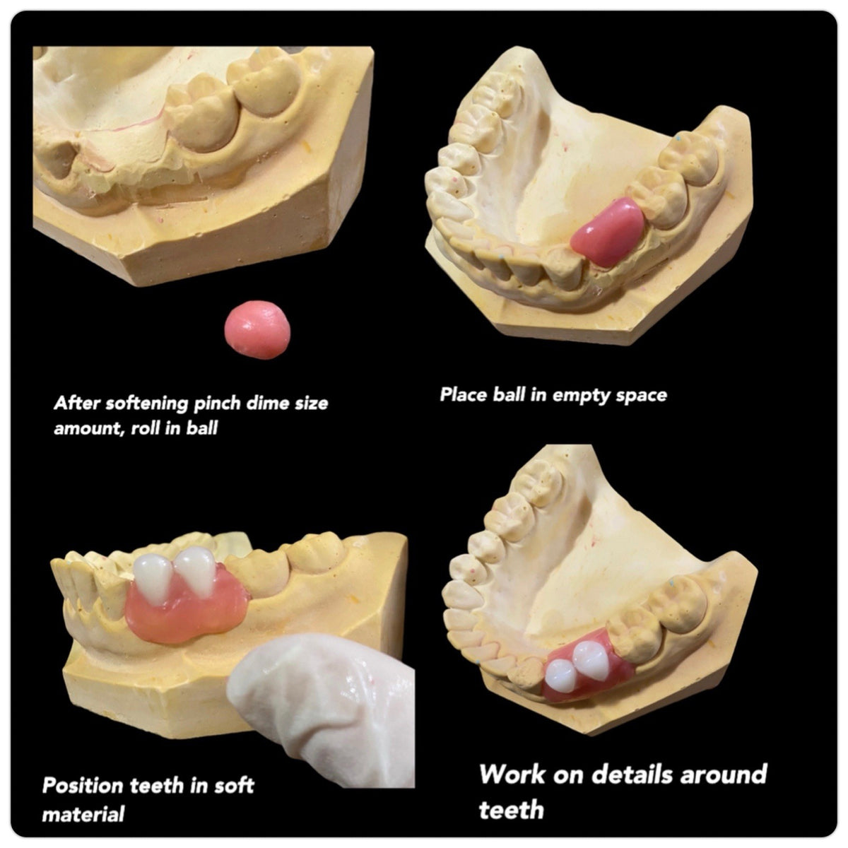 DIY Denture Kit with Alginate for Custom Fit Upper & Lower Teeth - Complete Home Impression Set