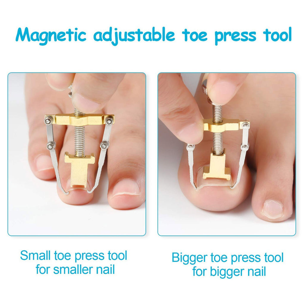 Ingrown Toenail Correction Lifter Tool - Nail Straightener & Paronychia Fixer
