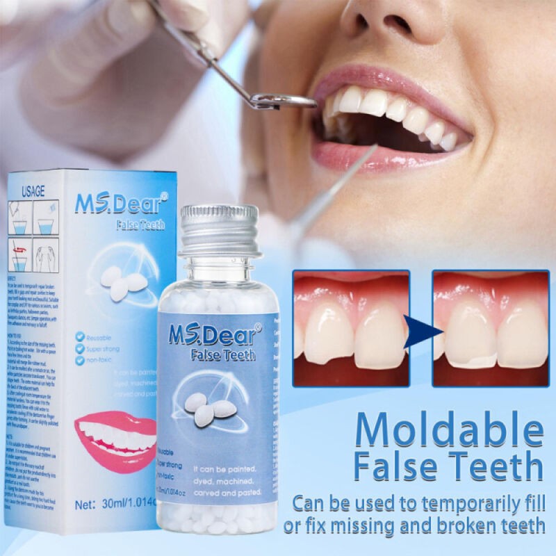 30ml Moldable Dental Repair Beads for Temporary Tooth Restoration