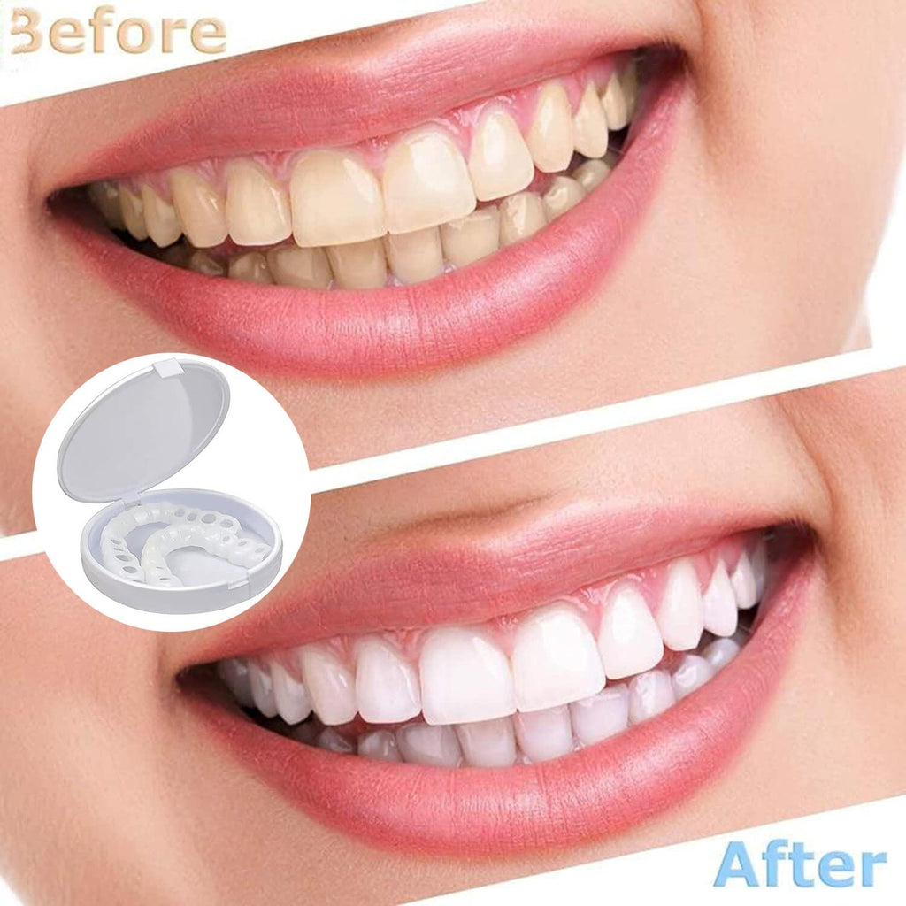 Snap-On Upper and Lower Dental Veneers Set - Reusable Teeth Cover for Adults