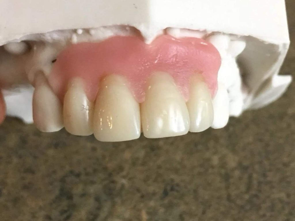 DIY Missing Tooth Replacement Kit - Custom Fit Partial Flipper for 1-6 Front Teeth