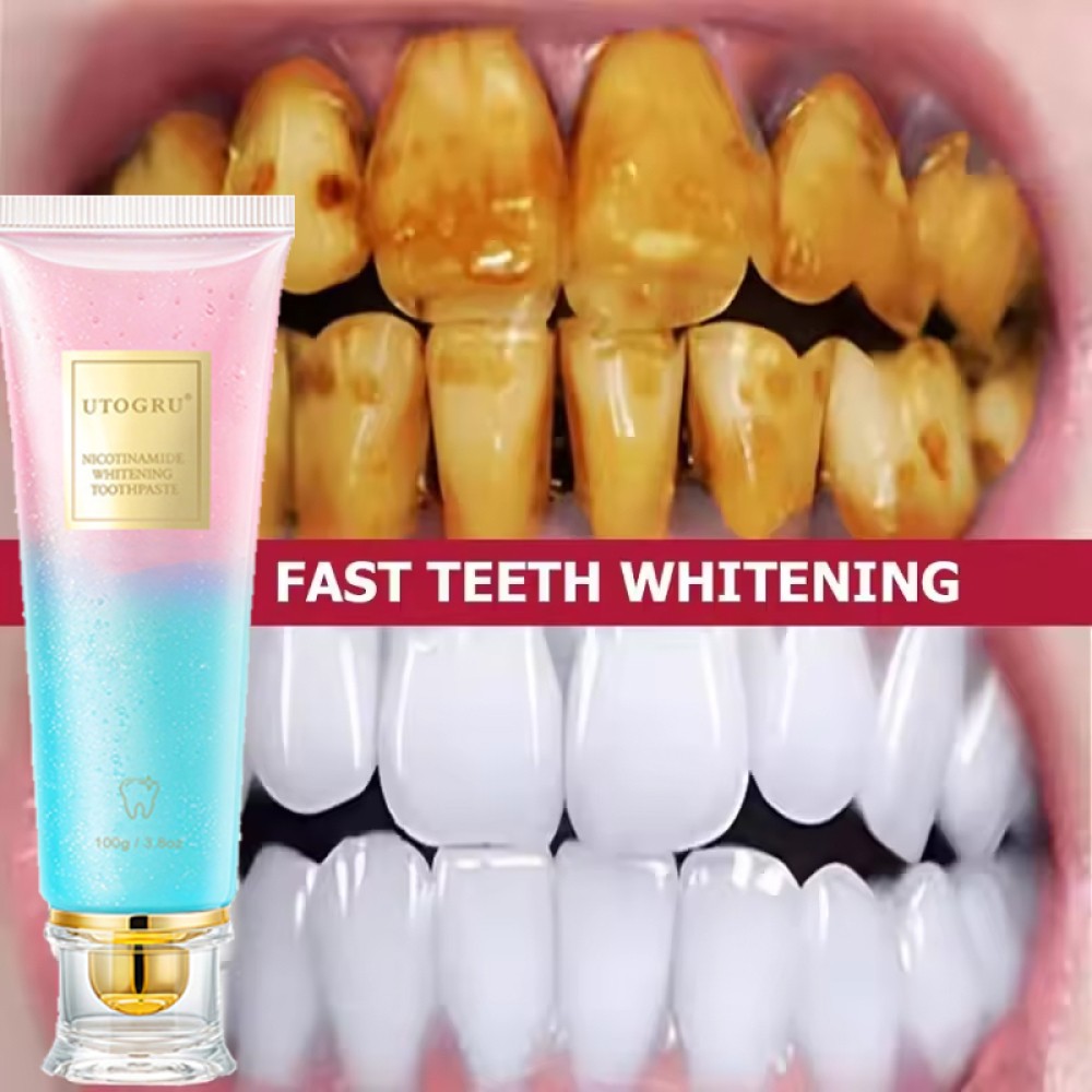 Niacinamide Whitening Toothpaste - Multiple Pack Sizes, Enamel Care & Fresh Breath