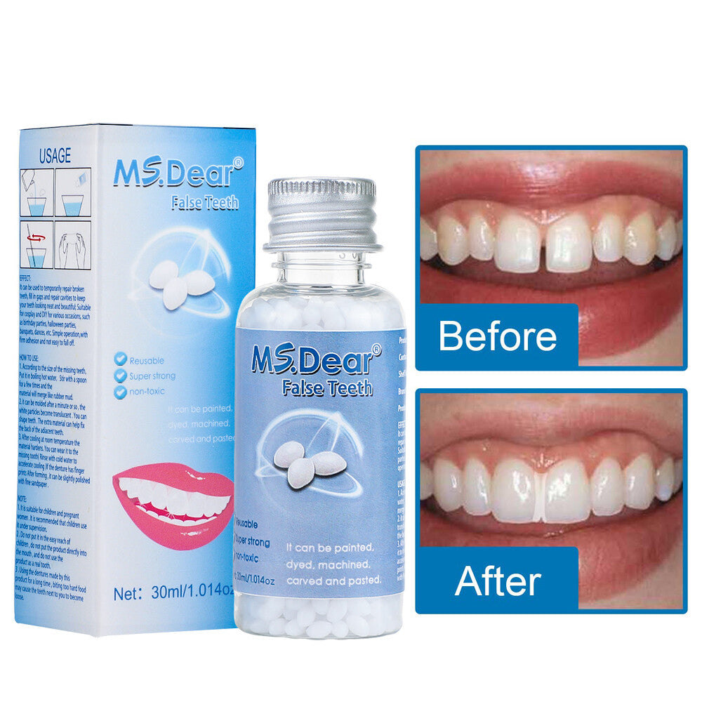 Reusable Moldable Tooth Repair Kit with Beads for Temporary Dental Fixes