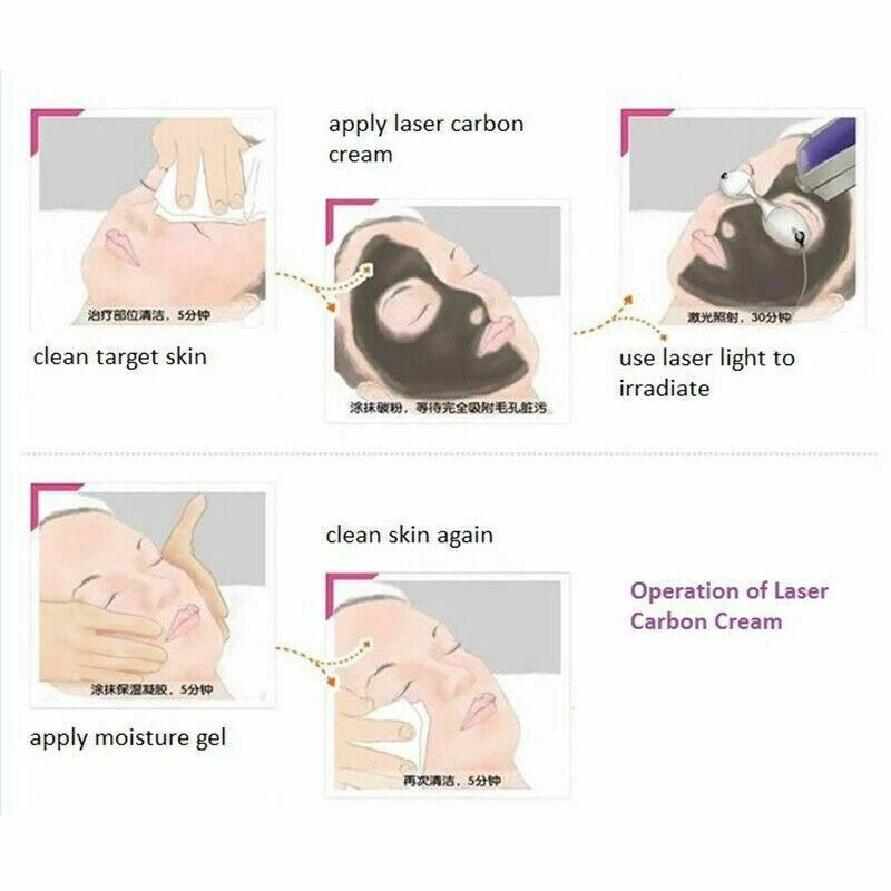 Carbon Peel Gel Mask for Laser Facial Rejuvenation 3X 80ML