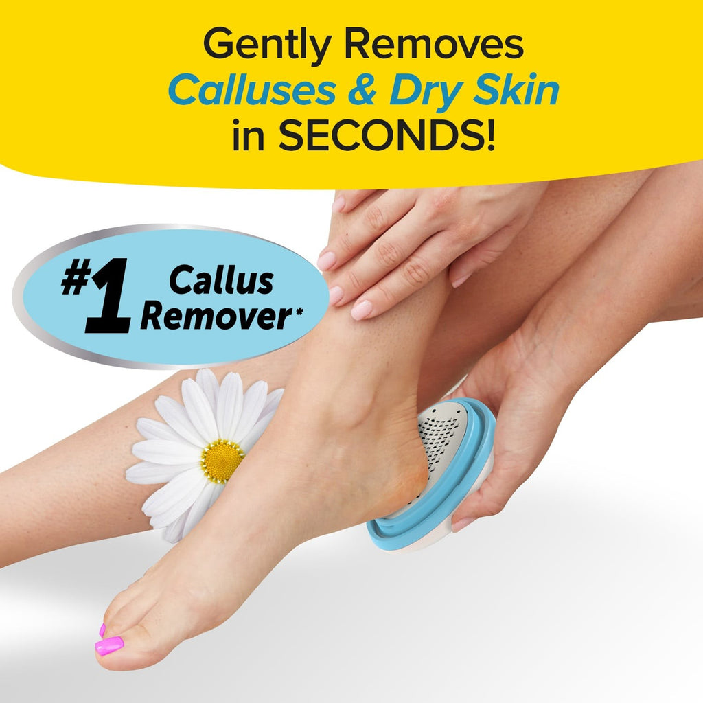 PedEgg Classic Callus Remover for Feet - Exfoliates Dry Skin & Calluses