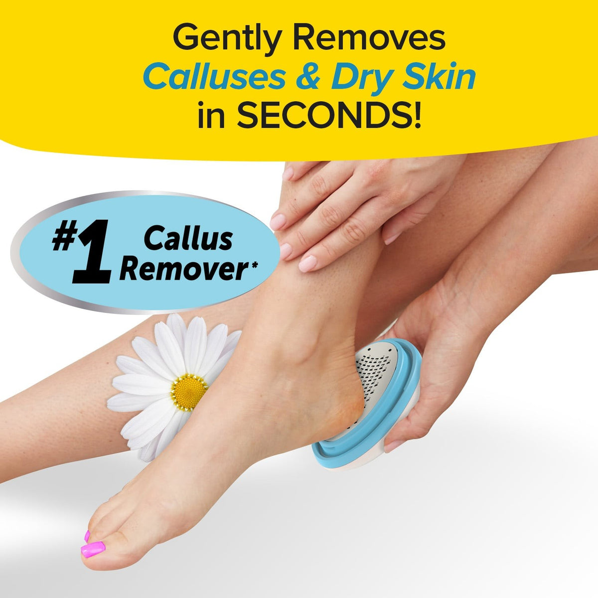 PedEgg Classic Callus Remover for Feet - Exfoliates Dry Skin & Calluses