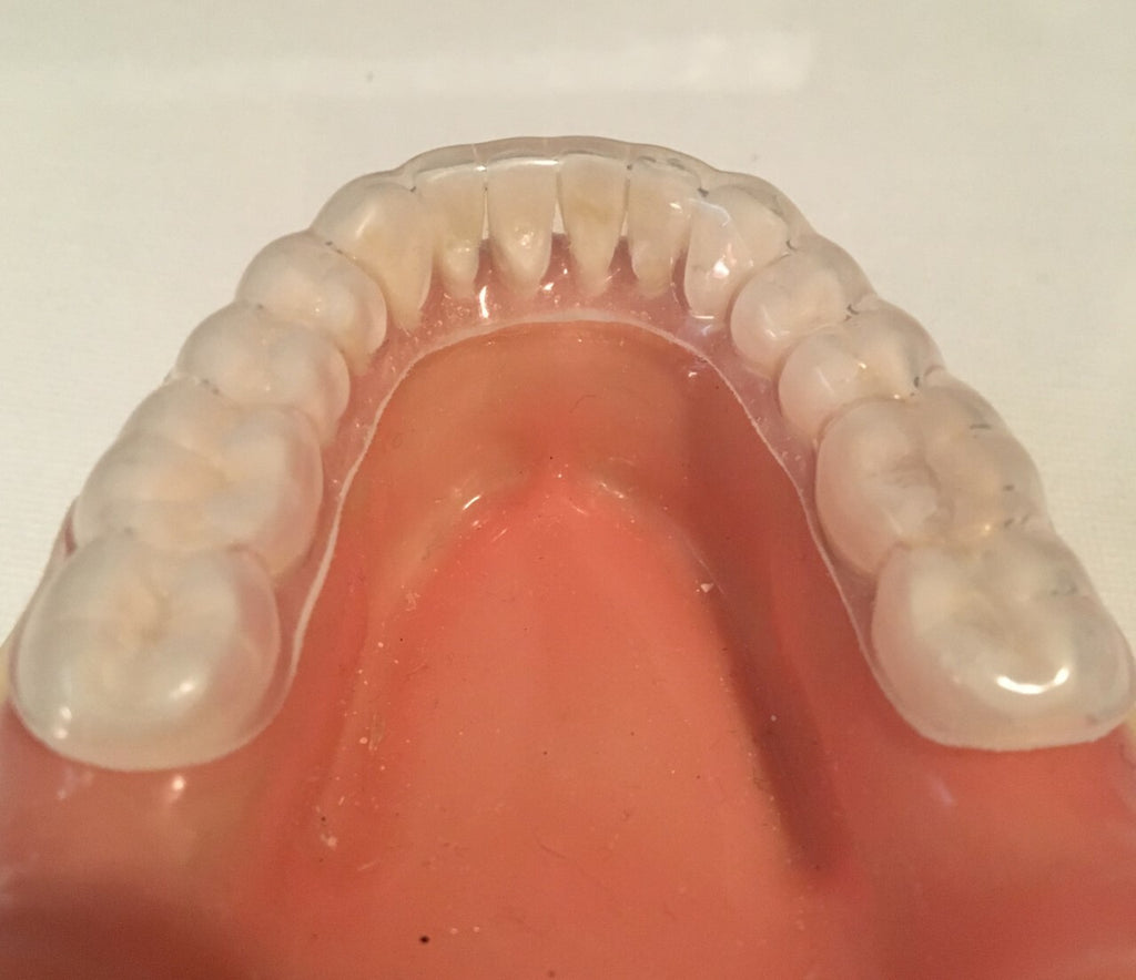 Custom Dental Retainers Set Upper and Lower Made in USA - Clear Aligners