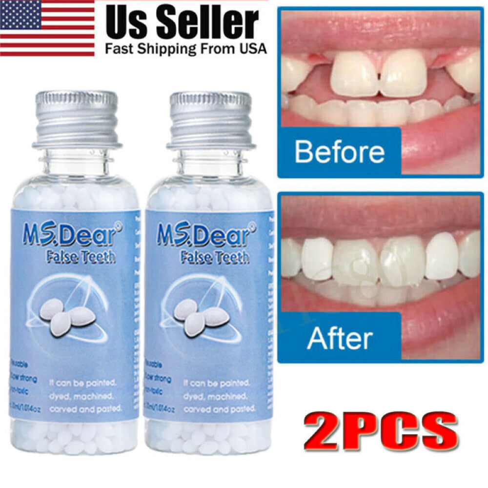 Teeth Repair Kit - Temporary Dental Filling & Missing Tooth Replacement