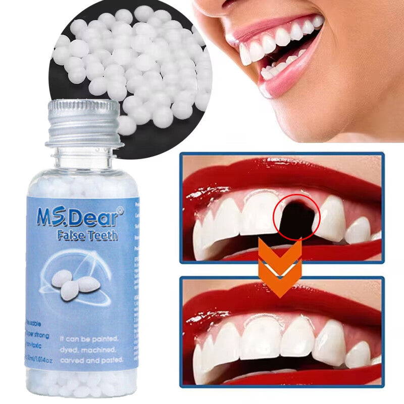 Temporary Moldable Dental Repair Beads for Broken Teeth - 30ml