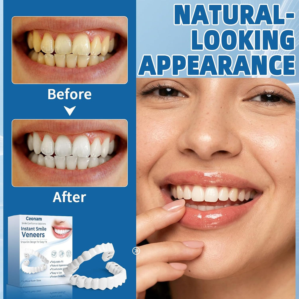 Adjustable Snap-On Veneers Dentures Set – Upper & Lower Tooth Covers