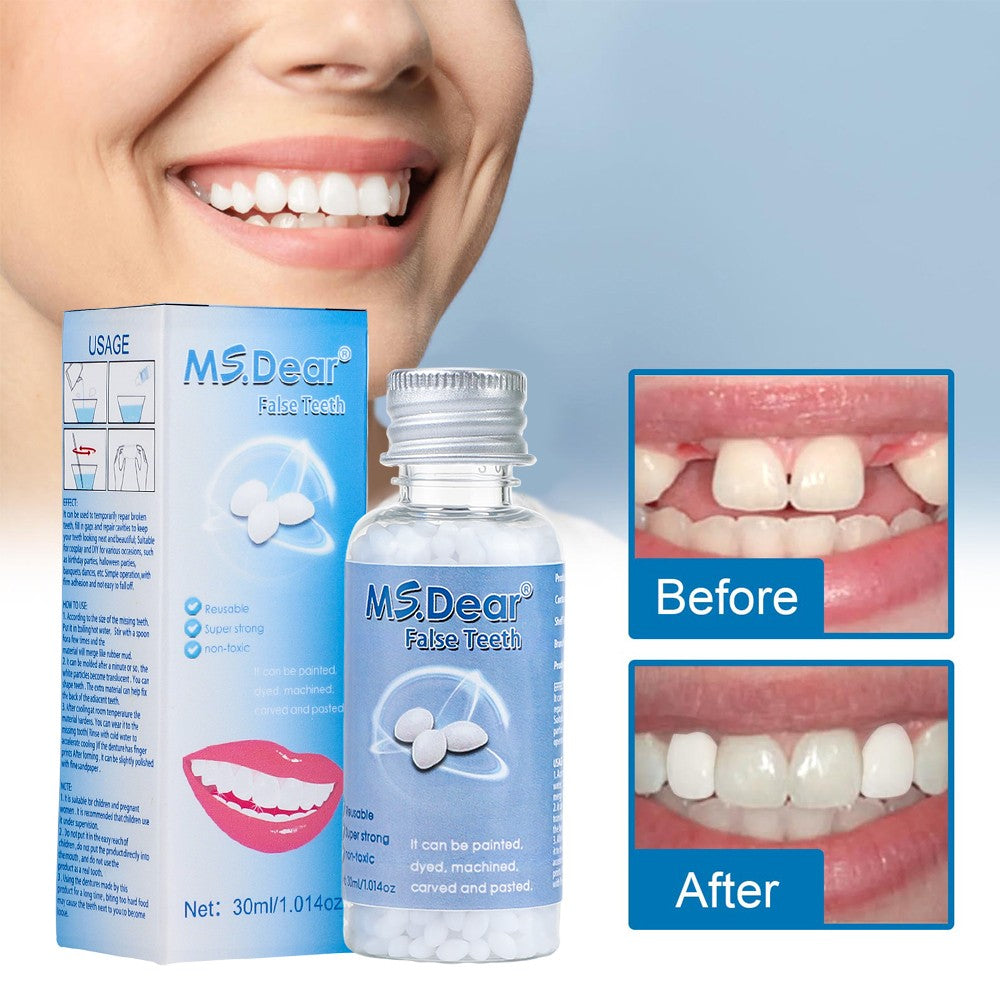 Tooth Repair Kit - Temporary Filling Beads for Broken & Chipped Teeth