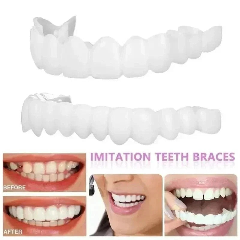 Snap-On Veneers Teeth Kit for Women and Men - Instant Bright Smile