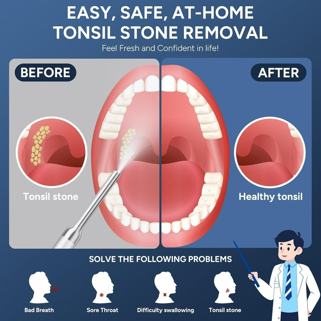 Visual Tonsil Stone Remover Kit with Camera and LED Light