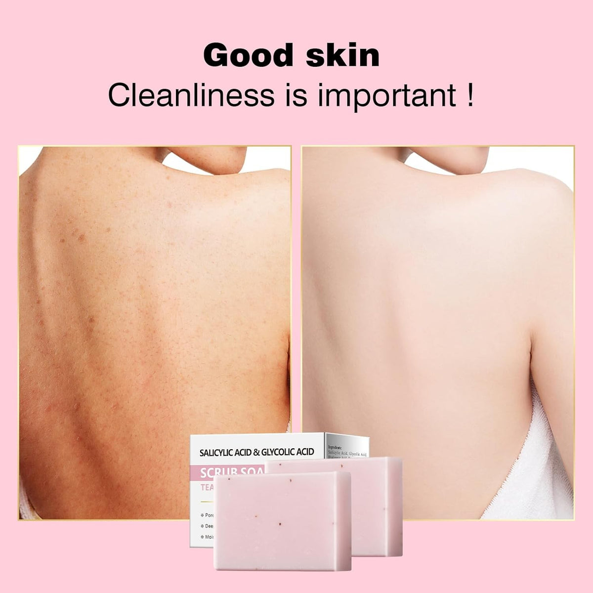 Salicylic Acid Facial & Body Exfoliating Soap Bar with Glycolic & Tea Tree