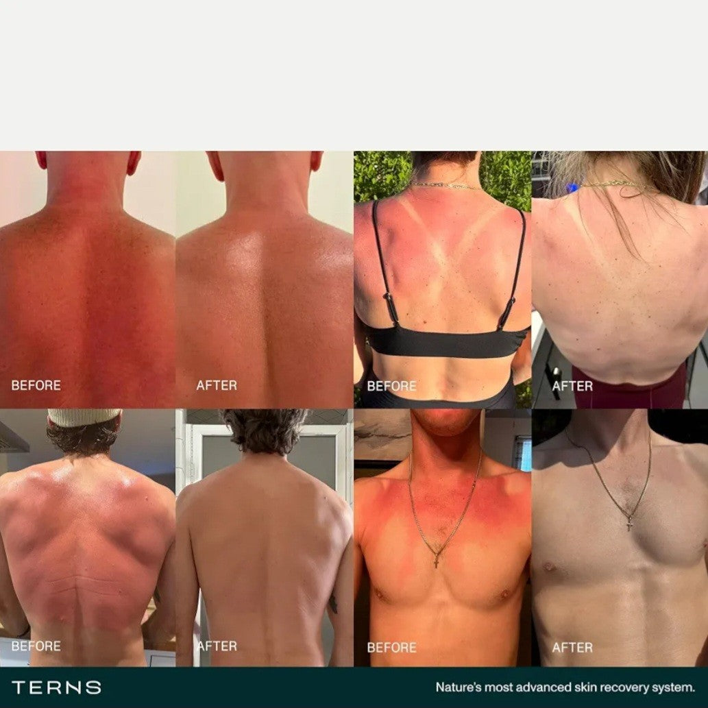 After Sun Lotion for Sunburn Relief & Skin Recovery - 2 Oz