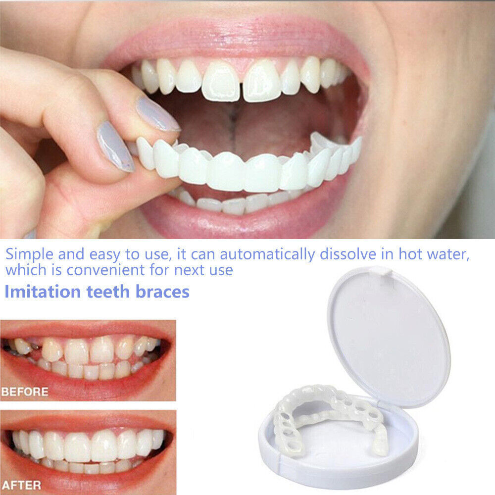 Snap-On Upper and Lower Dental Veneers Set - Reusable Teeth Cover for Adults