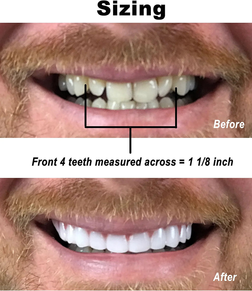Bright White Upper Veneer Cosmetic Teeth - Flex Fit Press-On Smile
