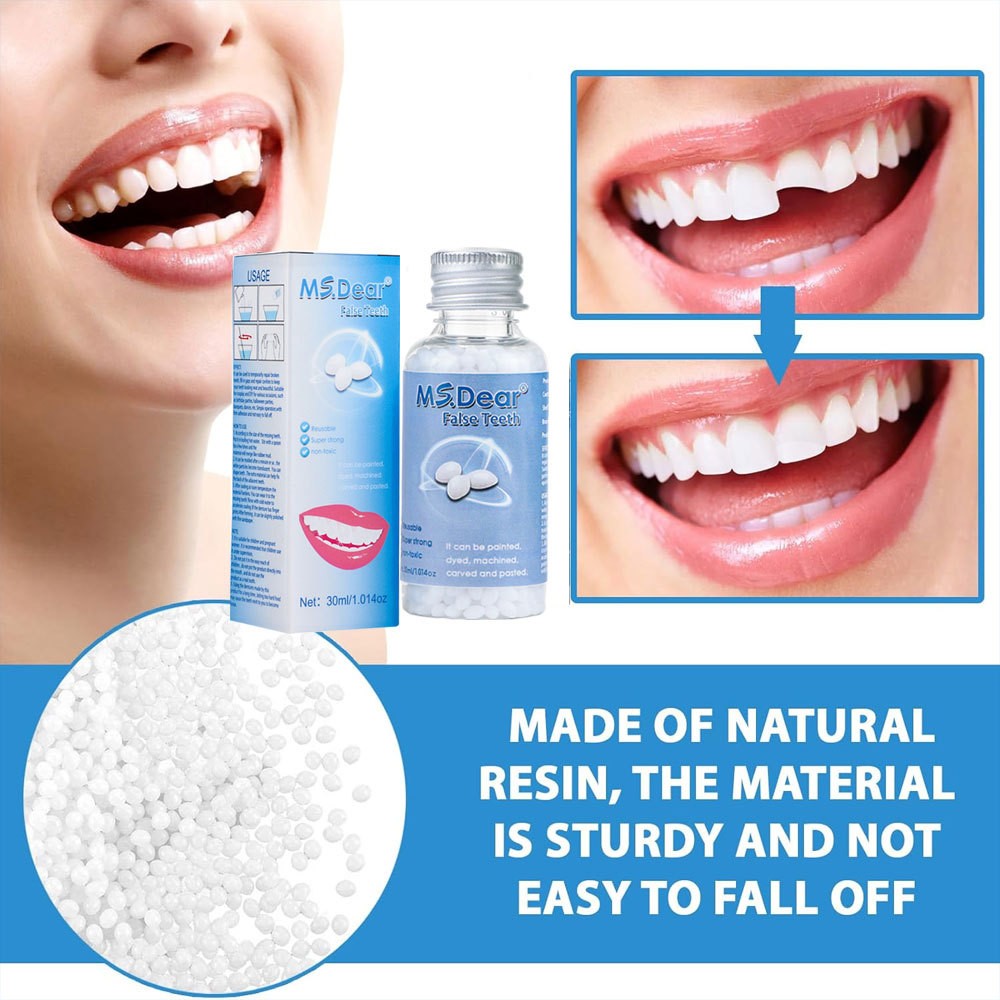 Tooth Repair Kit - Temporary Filling Beads for Broken & Chipped Teeth