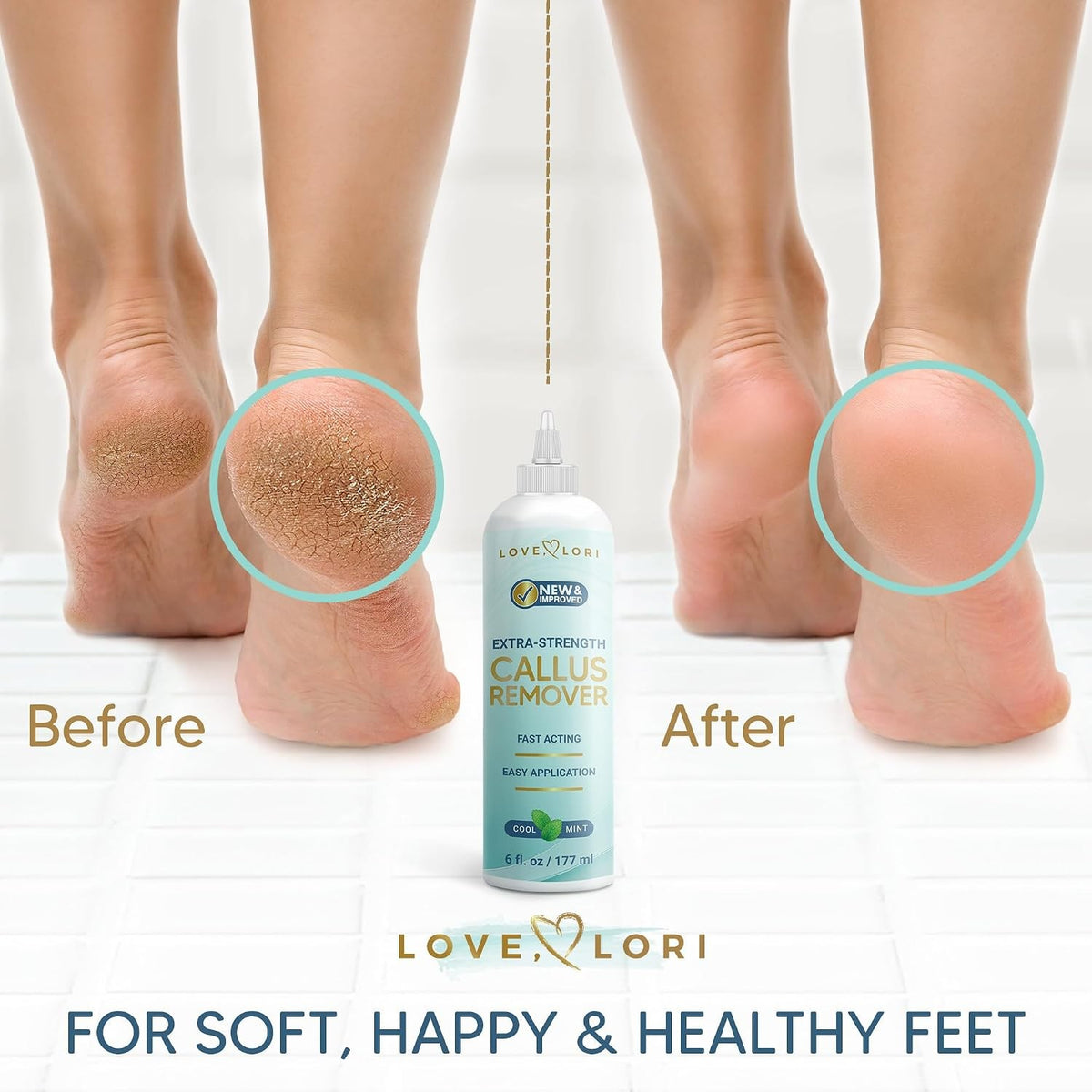 Extra Strength Foot Callus Remover Gel for Smooth Feet – 6Oz
