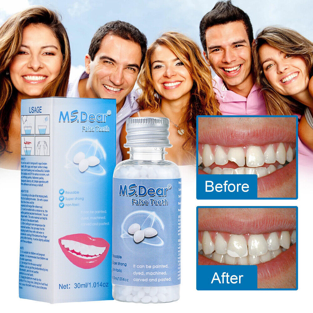 Temporary Teeth Repair Glue for Gaps & Broken Teeth - Moldable Resin