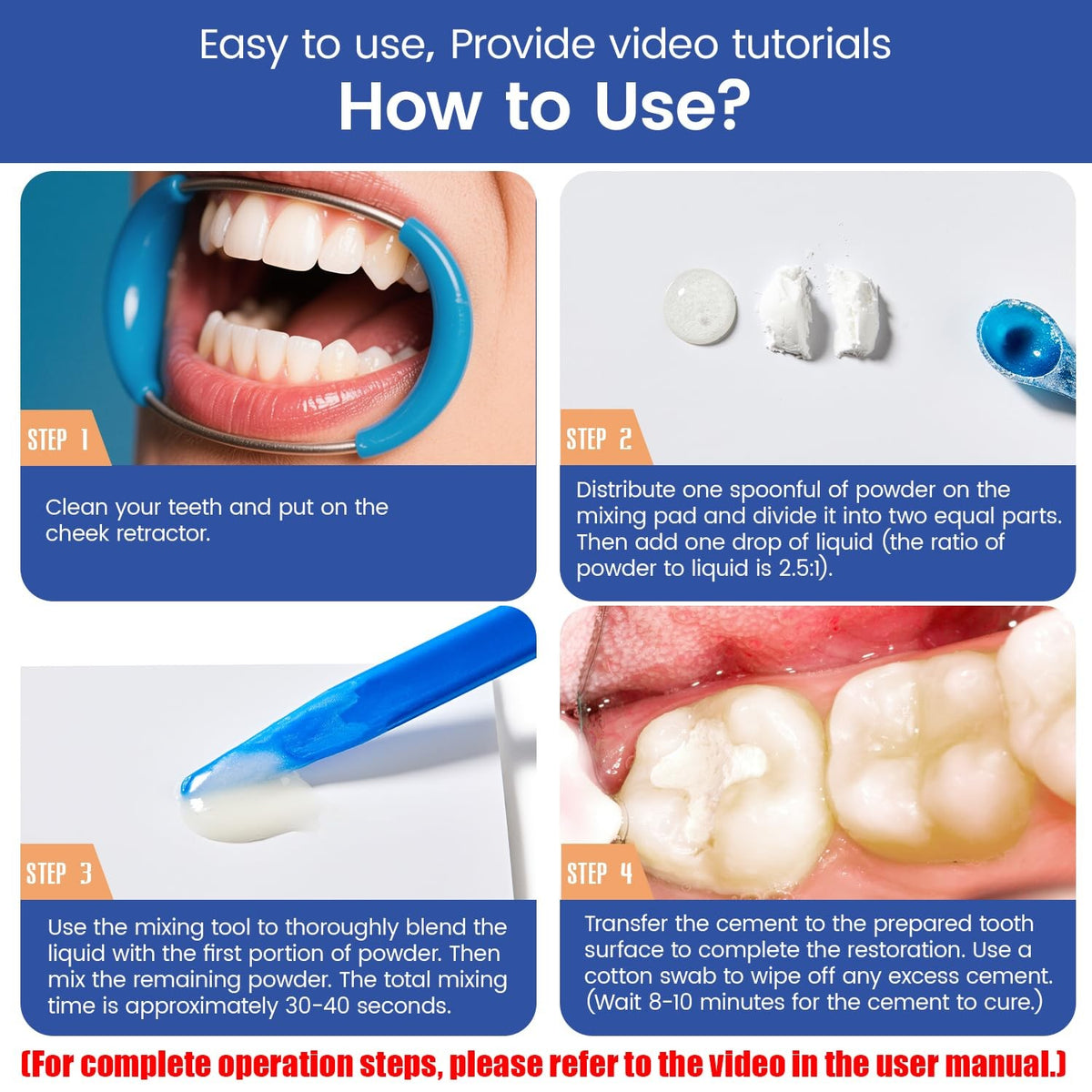 Dental Repair Kit with Zinc Oxide Eugenol - Tooth Filling & Cavity Filler
